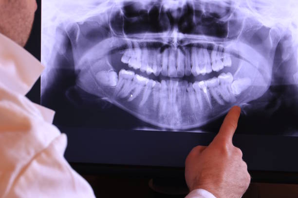 Best Emergency Treatment for Toothache in Everett, WA