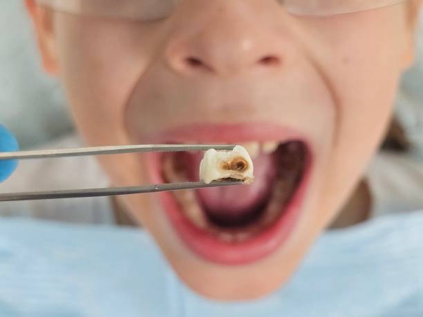 Best Pediatric Emergency Dentist in Everett, WA